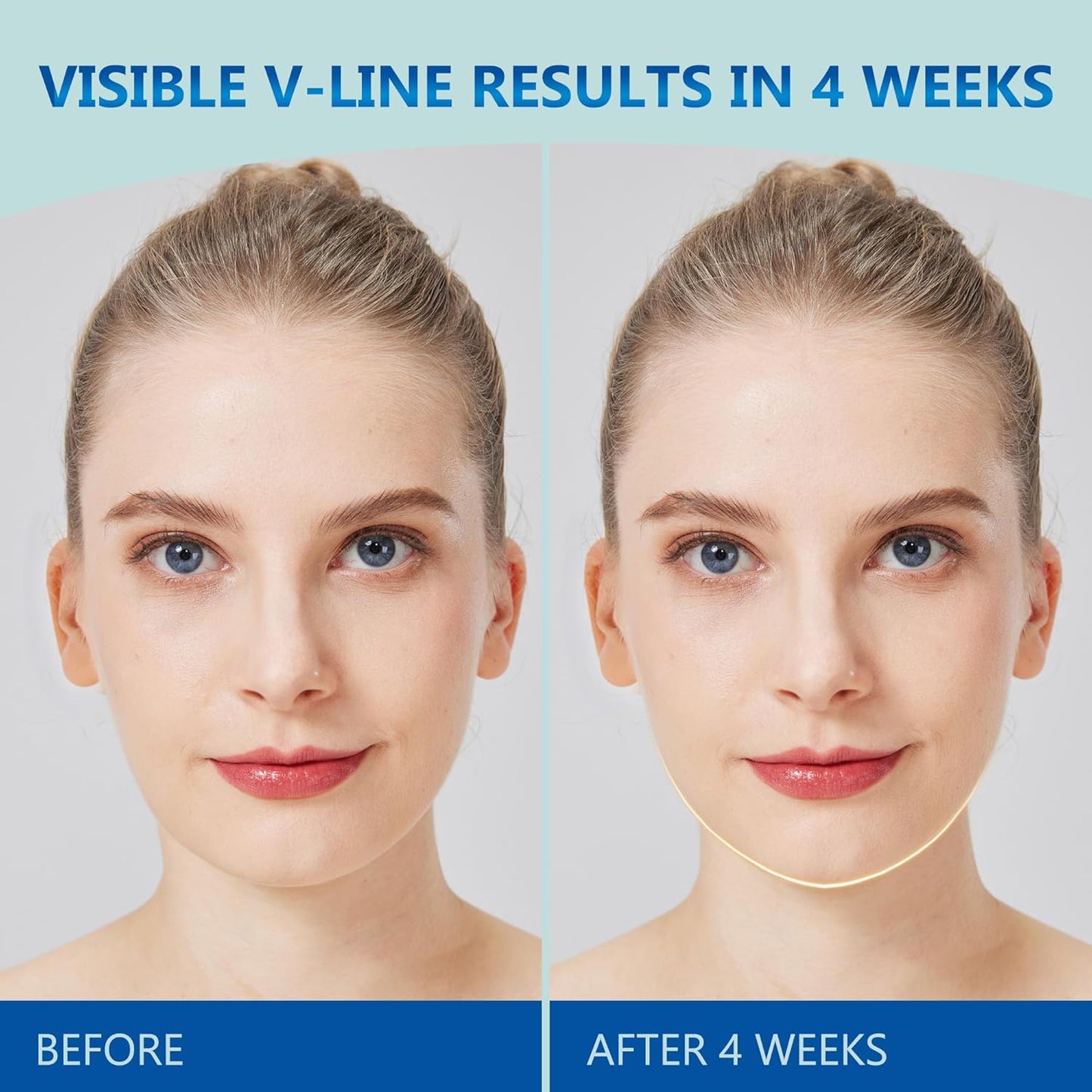 V Line Lifting Kit for Women, Double Chin Strap w/ 3D Face Roller & Hyaluronic Acid Serum