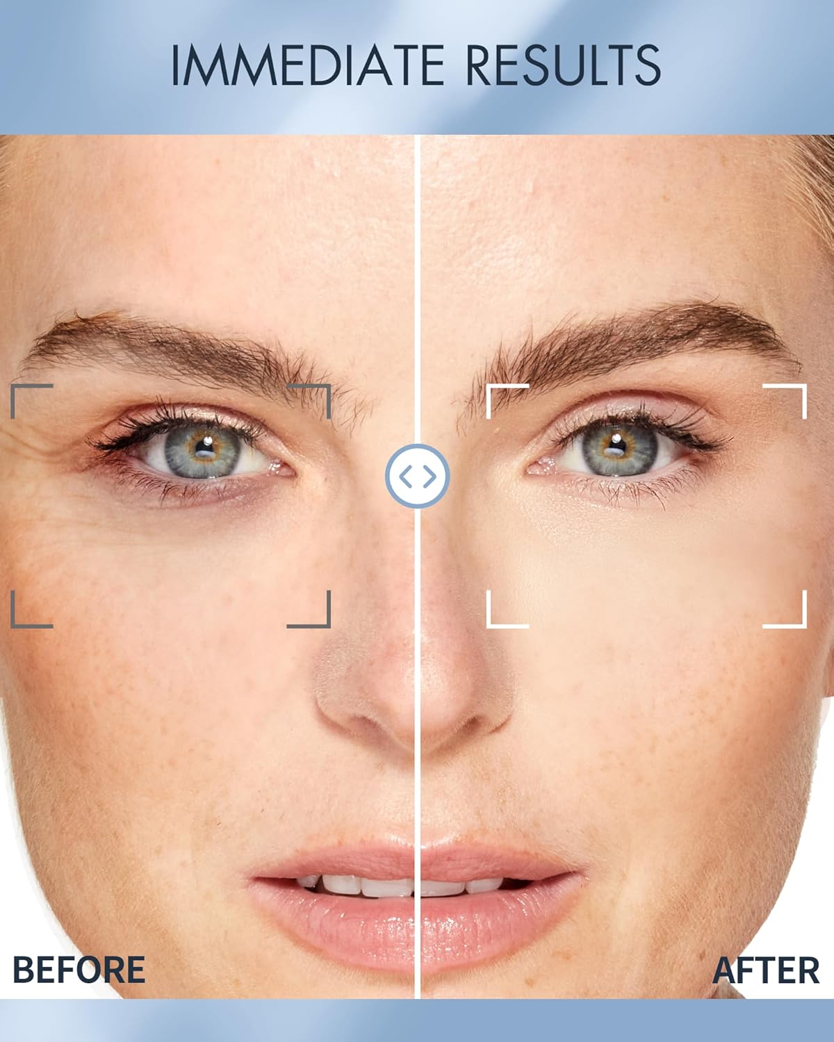 Depology - Replenish & Repair Under Eye Patches for Puffy Eyes - 60 patches
