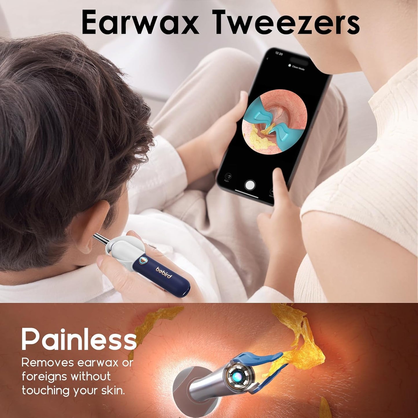 BEBIRD Earsight Plus: Ear Wax Removal Tool Camera & Light
