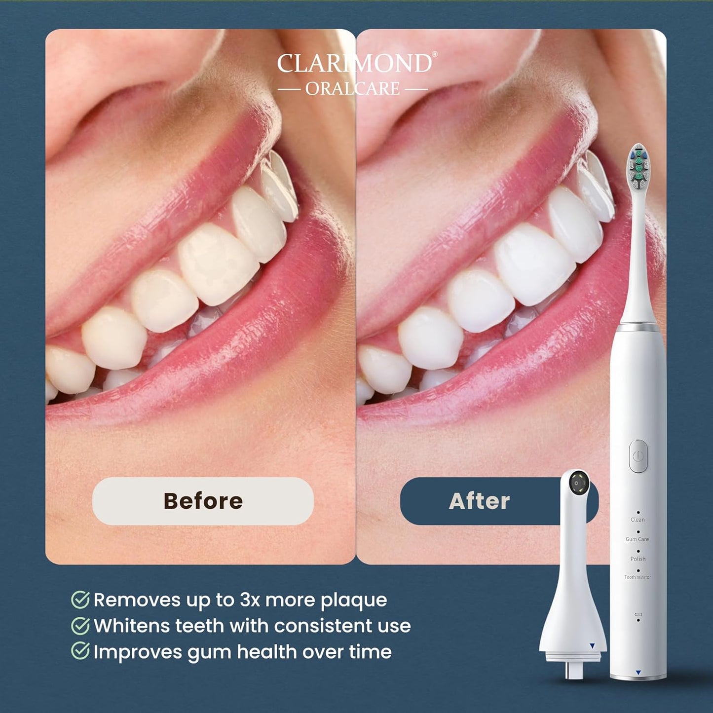 Electric Toothbrush White Ultimate Edition Advanced Deep Clean with HD Camera