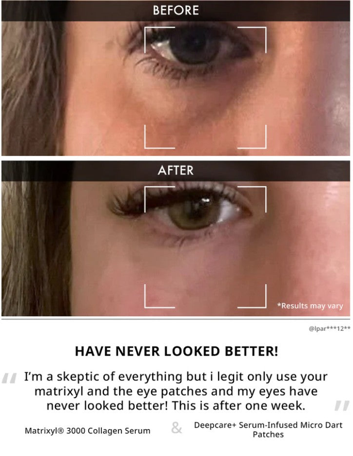 Depology - Deepcare+ Serum-Infused Micro Dart Patches - 4 pairs