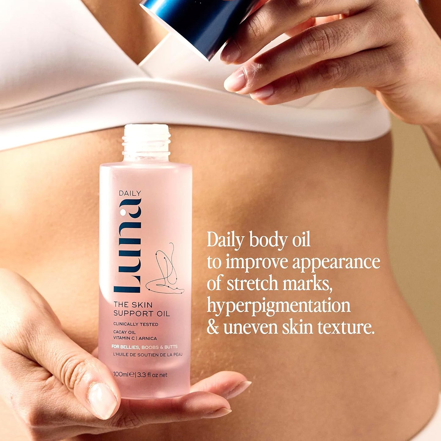 Skin Support Oil for Stretch Marks | Hydrating & Nourishing Body Oil
