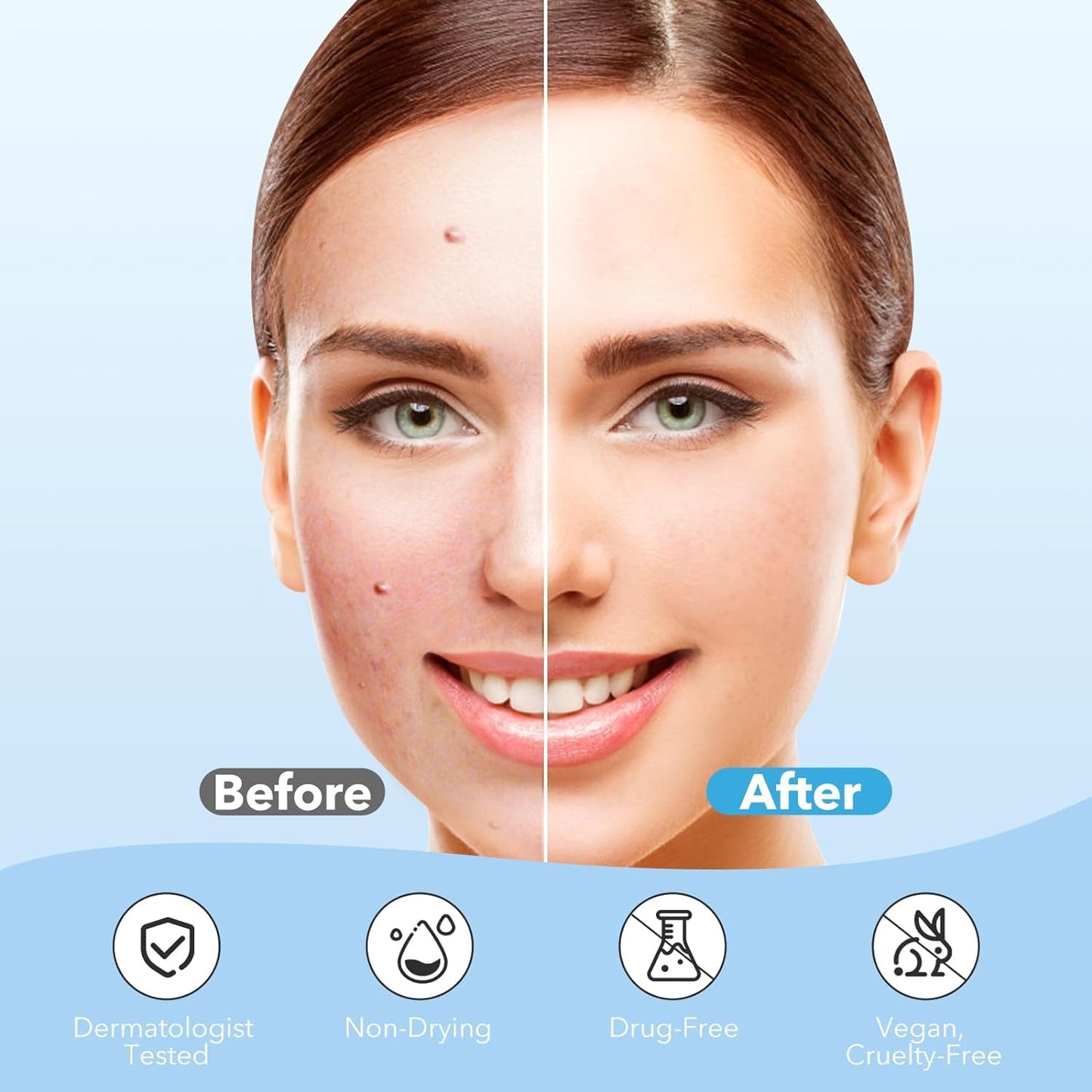 Pimple Patches for Face, Cute Round Shape Zit Covers - 288 pcs.