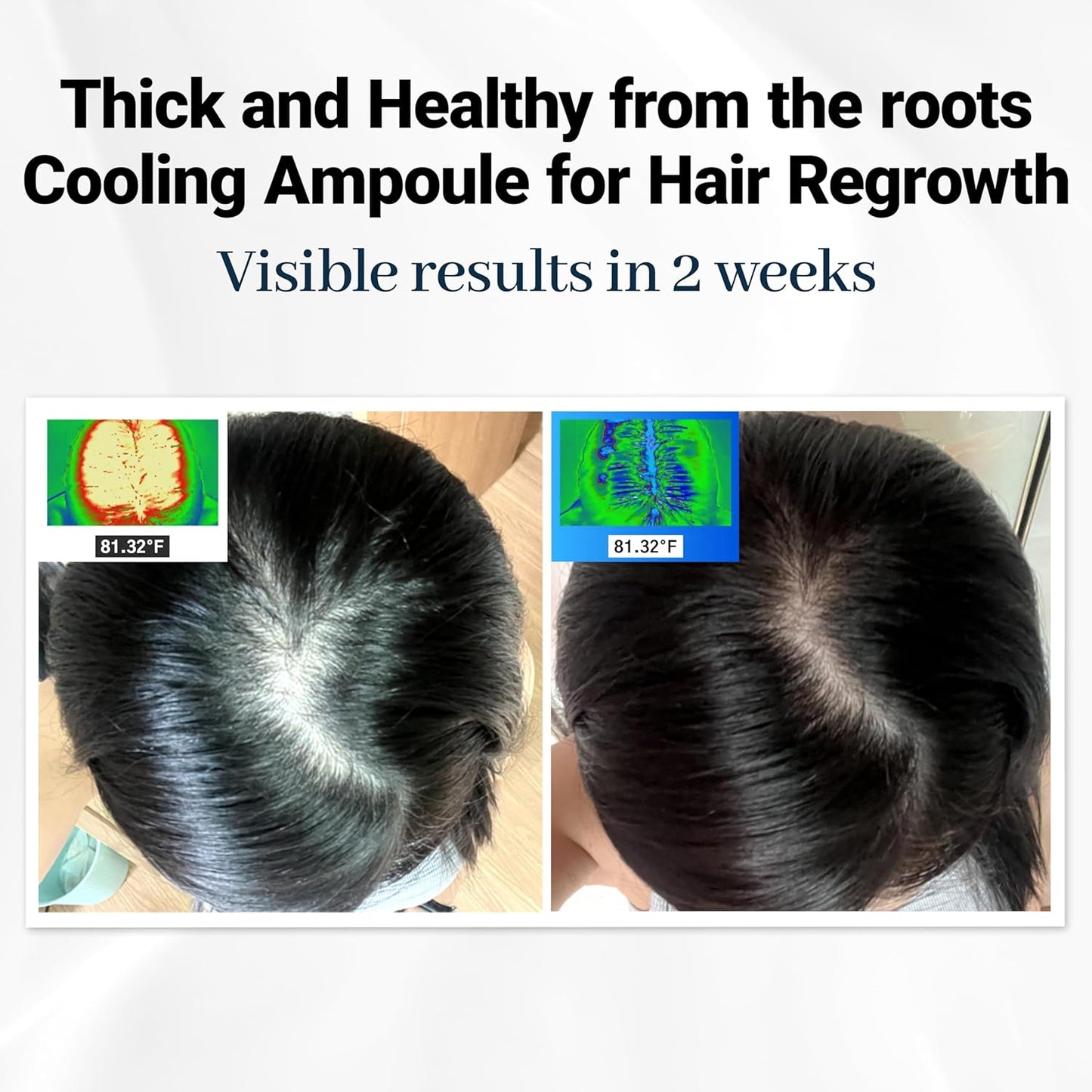 Hair Ampoule Scalphy Cooling Hair Ampoule, Premium Hair Loss Treatment