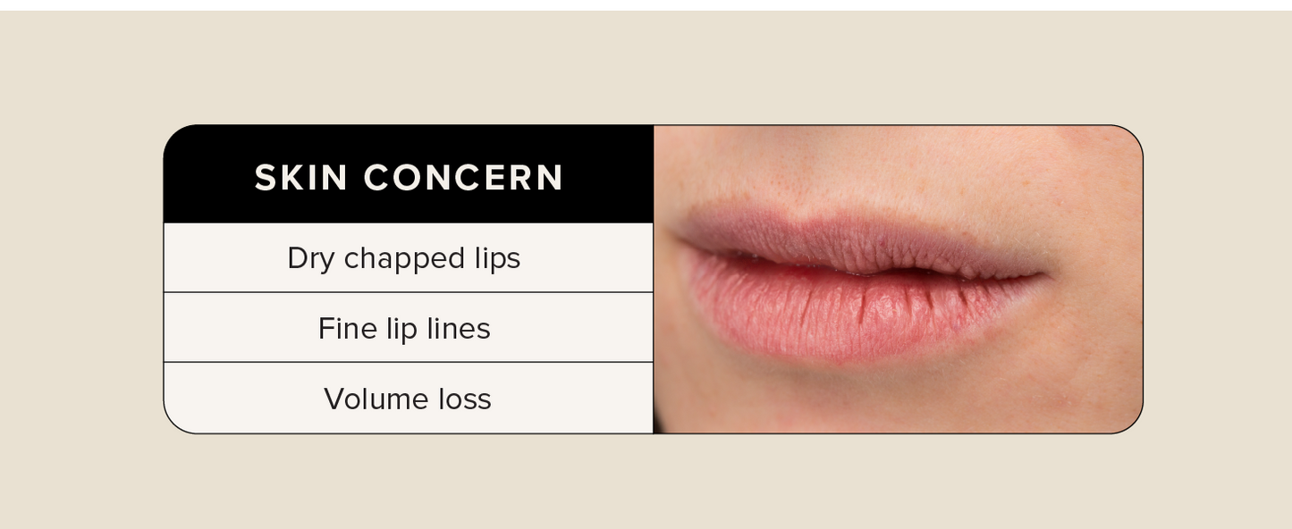 Asterwood Lip Treatment & Balm - with Volulip, Hyaluronic Acid, & Matrixyl 3000 - 0.5 Fl Oz