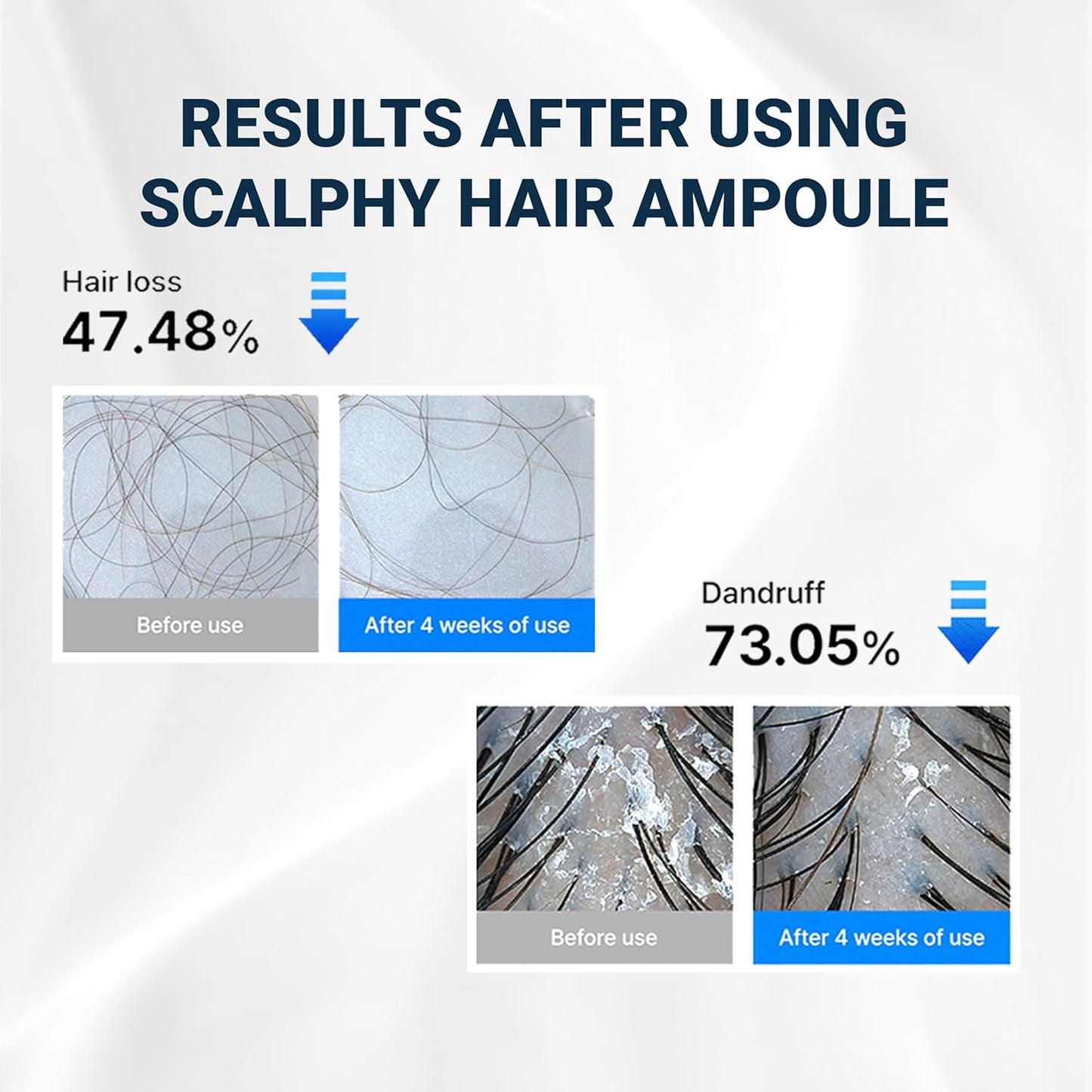 Hair Ampoule Scalphy Cooling Hair Ampoule, Premium Hair Loss Treatment