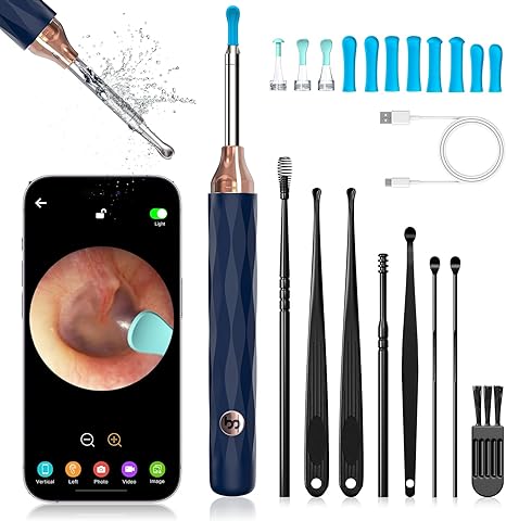 Ear Wax Removal Tool Camera with 6 Spoons, Ear Cleaner with Camera, 1080P Ear Scope